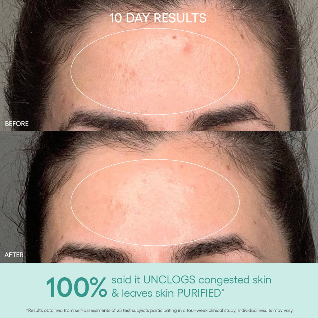 Algenist - GENIUS Liquid Skin Resurfacing 2% BHA Toner