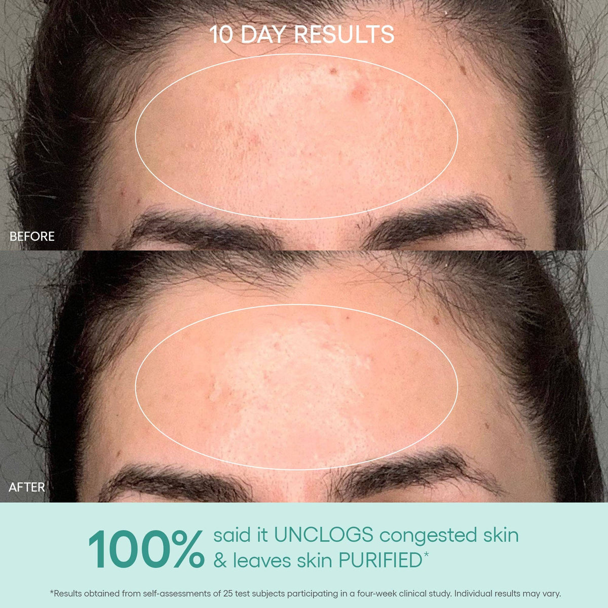 Algenist - GENIUS Liquid Skin Resurfacing 2% BHA Toner
