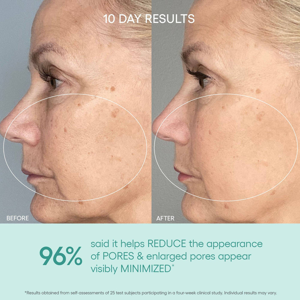 Algenist - GENIUS Liquid Skin Resurfacing 2% BHA Toner