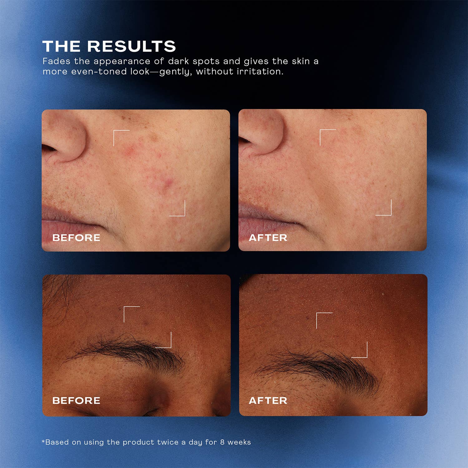 The Outset - Total Clarity Dark Spot Serum