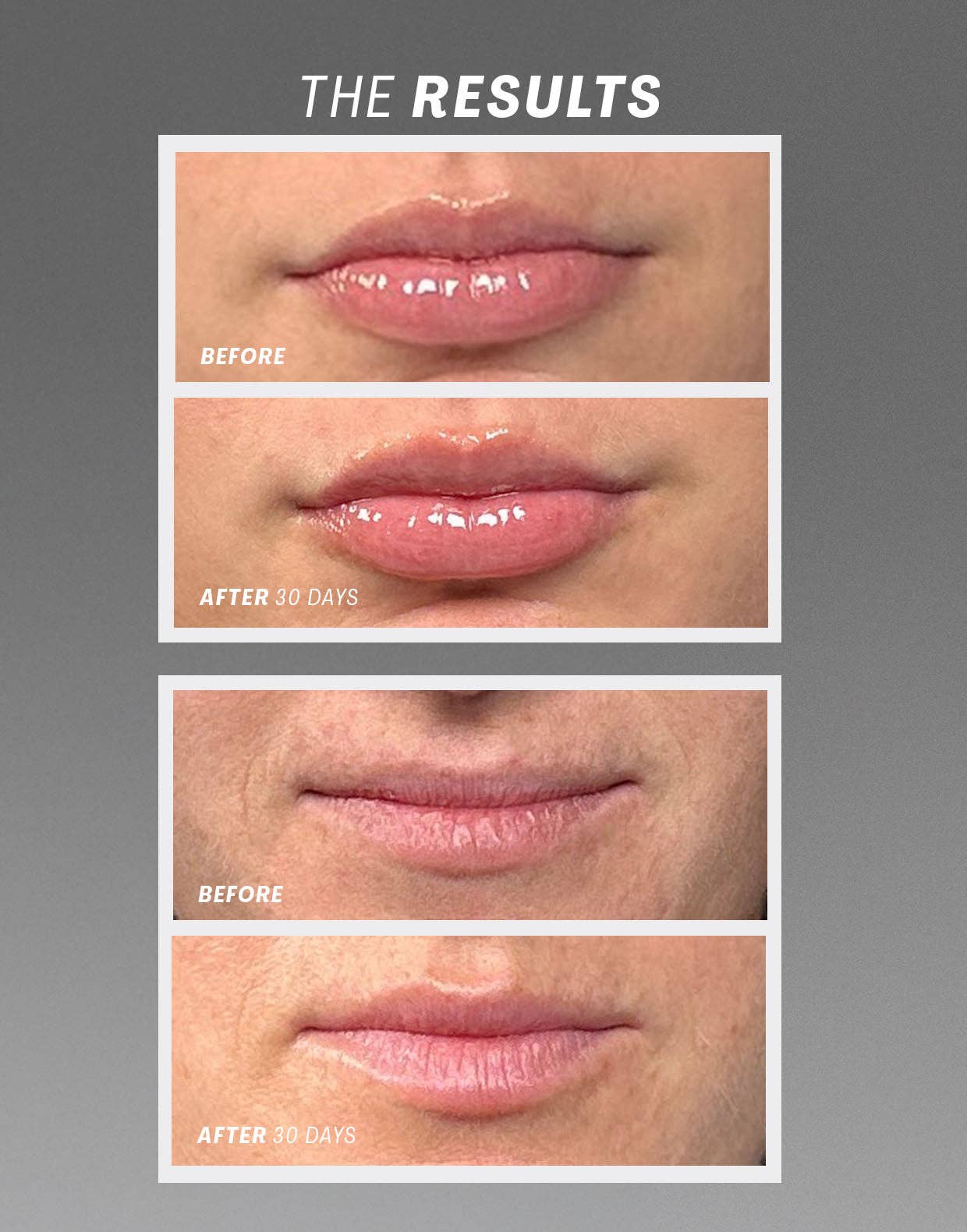 The Outset - Lip Oasisᵀᴹ Glossy Treatment