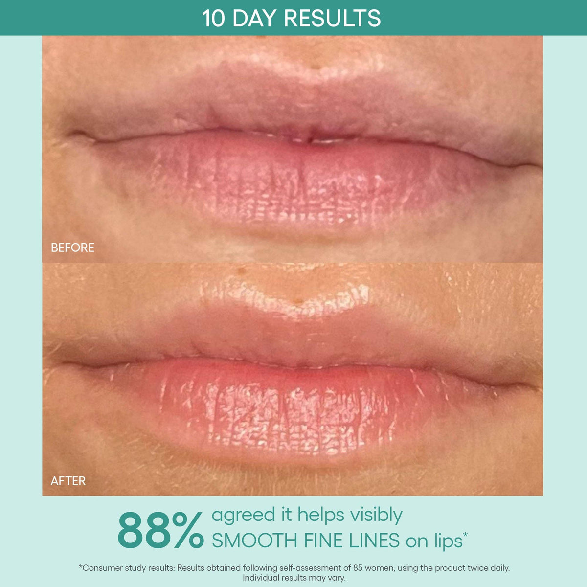 Algenist - GENIUS Liquid Collagen® Lip